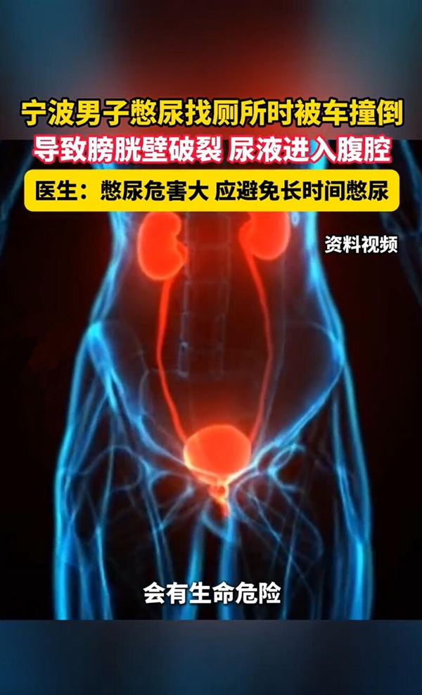 憋尿危害大！男子憋尿找厕所时被车撞：结果膀胱破裂